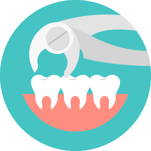 Hirurško vađenje umnjaka - Dental centar Slavija