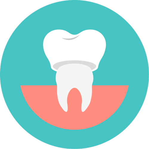 Elongacija zuba Dental centar Slavija